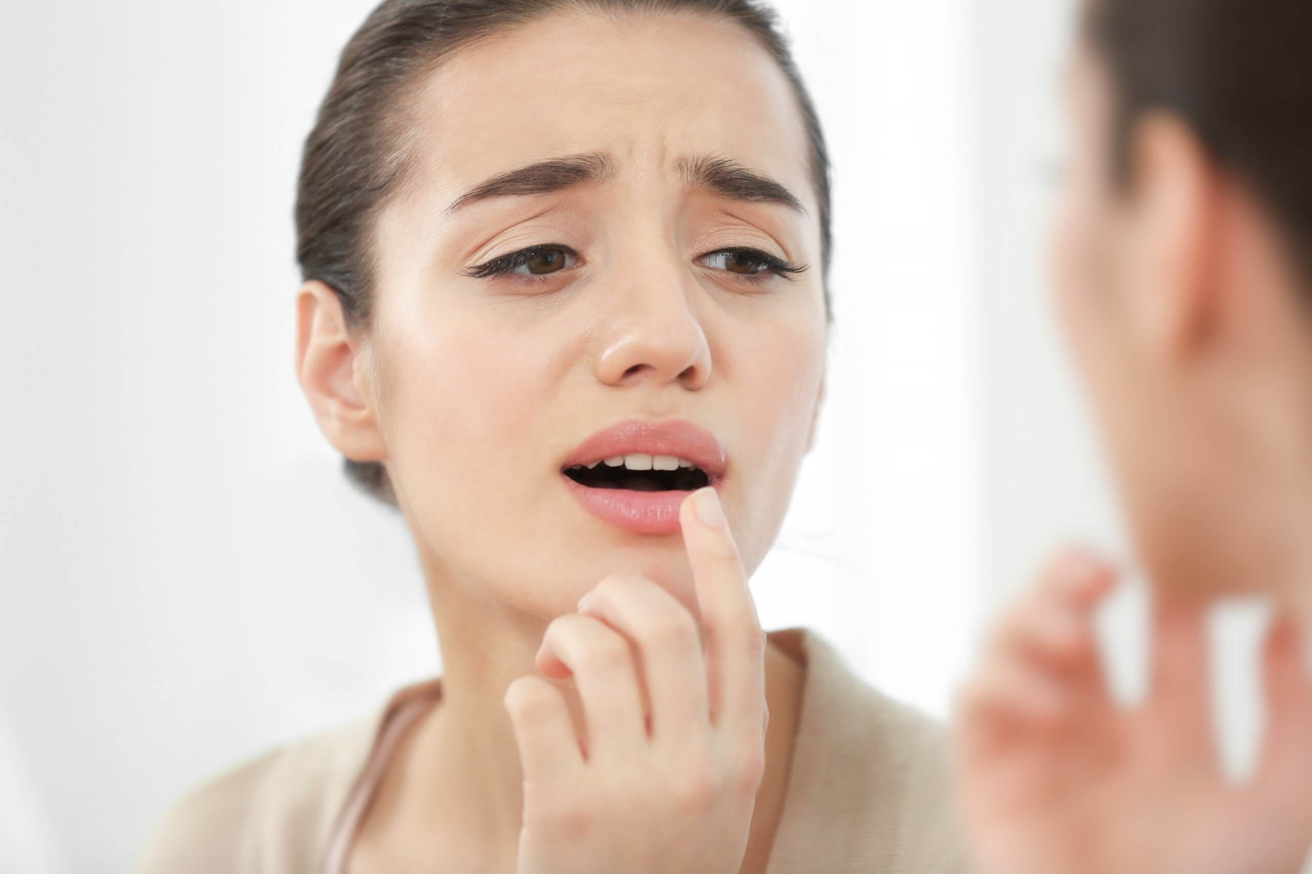 How to get rid of cold sores quickly VSM Pharmacy